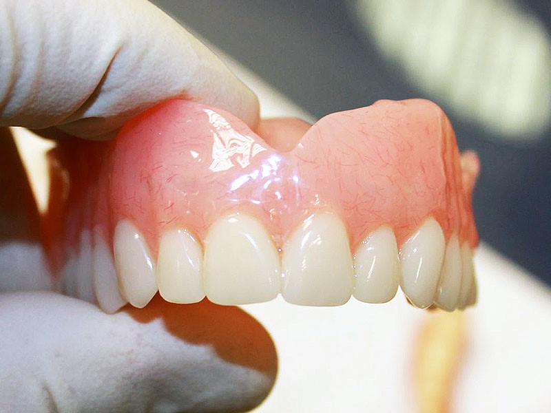 Pink Acid Queen Dentures Little Rock IA 51243